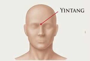 Main Meridian Points for Pain in Different Body Parts (English Version) - Password is in Section 6.3 of the book